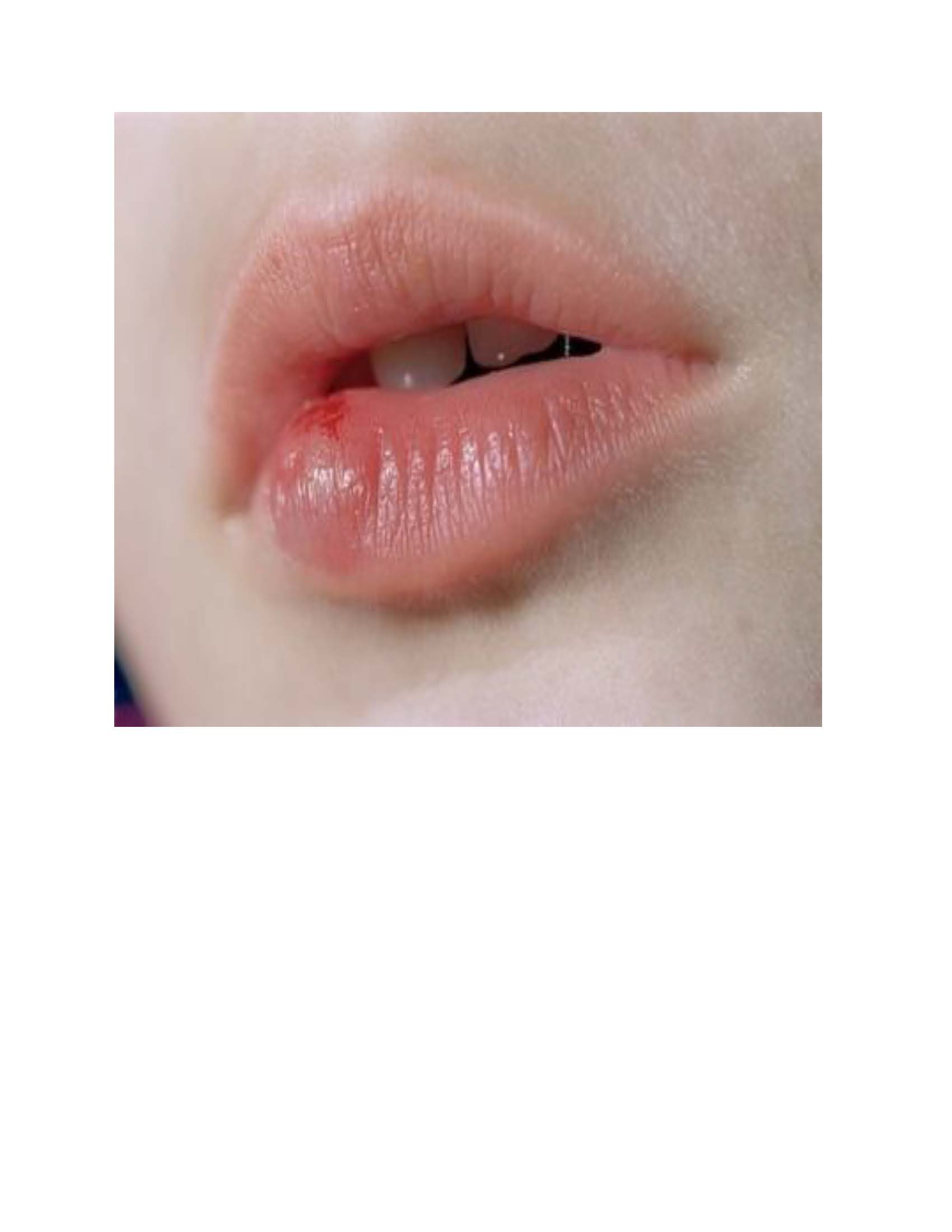 Untitled (Horse & Plough, Birds on Wire)