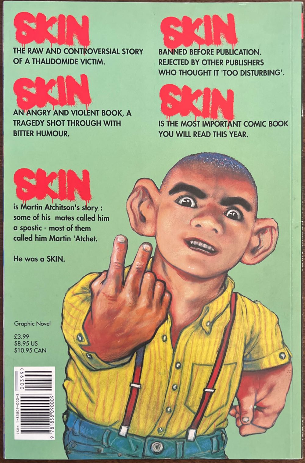 Skin - Peter Milligan (Tundra - Paperback) book collectible [Barcode 9781858090009] - Main Image 2