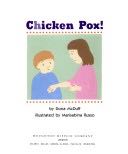 Chicken Pox!