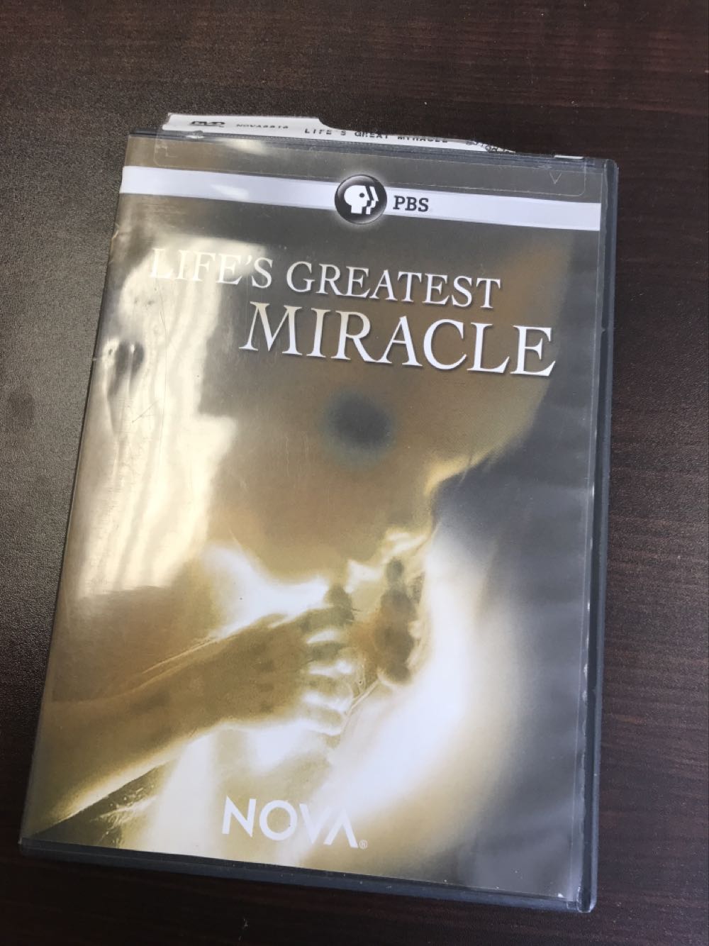 Lifes Greatest Miracle
