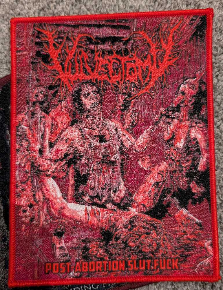 Vulvectomy - Post Abortion Slut Fuck