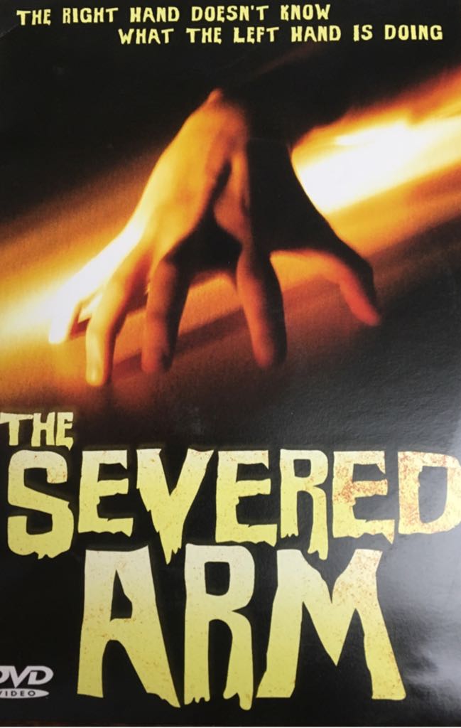 The Severed Arm