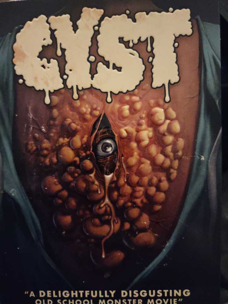 Cyst