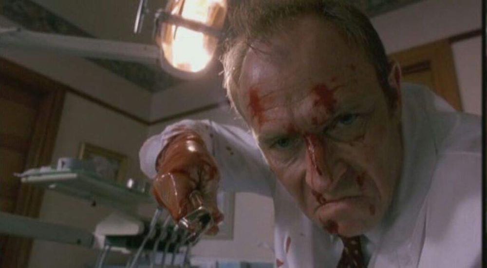 The Dentist (In The Dentist Collection, Vestron Video) Blu-ray movie collectible [Barcode 031398688631] - Main Image 4