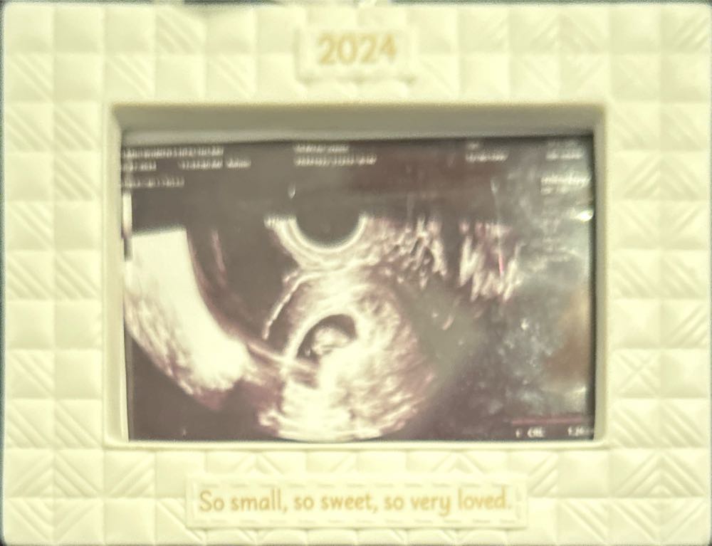 Hallmark Keepsake Christmas Ornament So Very Loved Sonogram Photo Frame Porcelain Baby’s 1st Christmas  (Picture Ornament) ornament collectible [Barcode 661127038545] - Main Image 2