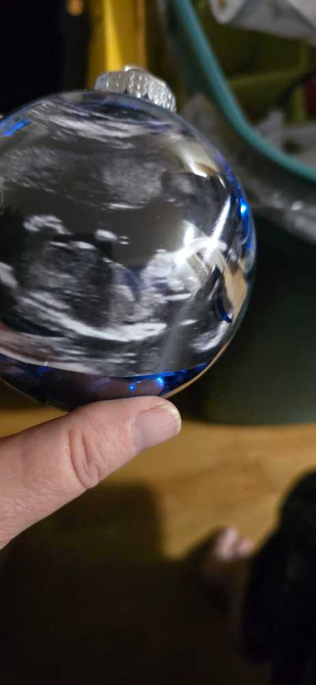 Ultrasound HESSDORFER   ornament collectible - Main Image 3