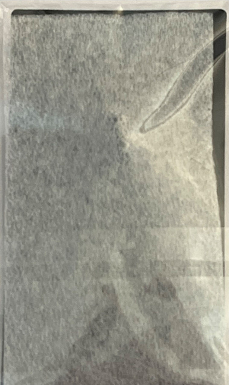 Gold Remy  pin collectible - Main Image 2