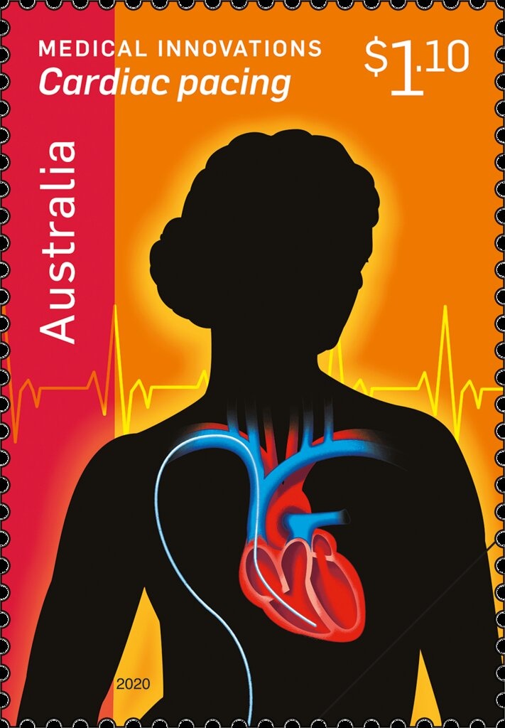 Koala (Phascolarctos cinereus)