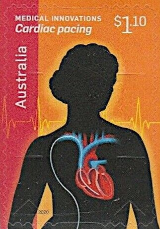 Waterlili and Gaya (linocut), Banduk Marika (1983)