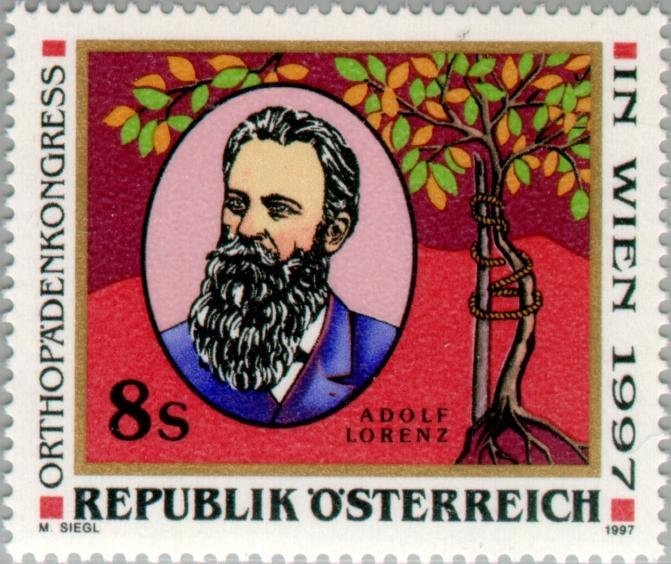 Eurasian Woodcock (Scopolax rusticola)